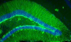 Genetically-induced expression of a light-activated ion channel and fluorescent protein (green) in neurons that were “born” just prior to traumatic brain injury.