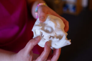A 3D printed skull is held in two hands, pointing to a small section on the lower jaw that was removed in surgery. 