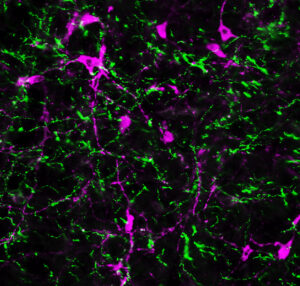 Expression of a fluorescent protein (green) can be seen in prefrontal cortex projections to the area where the brainstem connects to the spinal cord. Cortical terminals are shown in contrast with epinephrine and norepinephrine-producing neurons (magenta), which play an important role in the fight or flight stress response.